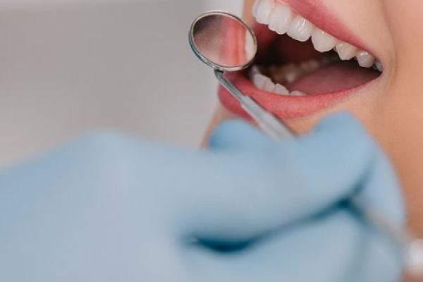 Whitening Teeth: A Comprehensive Guide